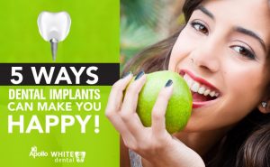 5 Ways Dental Implants Can Make You Happy!